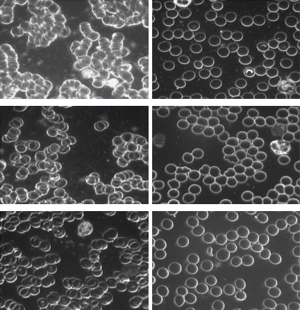 Blood viscosity samples, before and after grounding